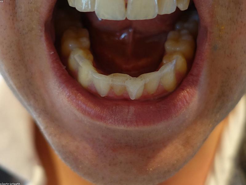 Cosmetic Dentistry